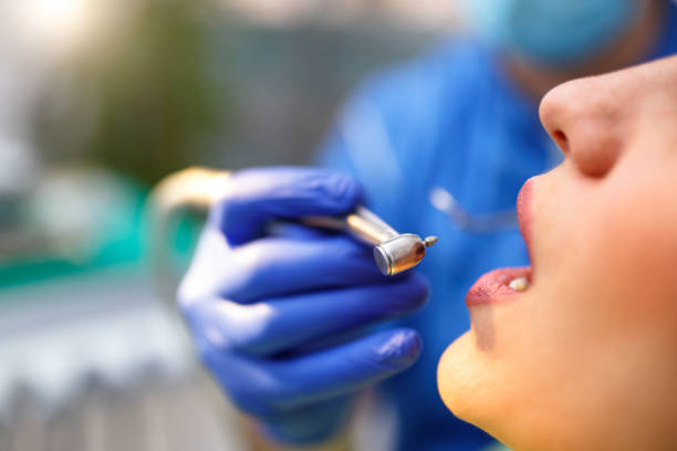 Dental Inlays and Onlays in Succasunna, NJ